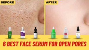 6 Best Face Serum for Open Pores